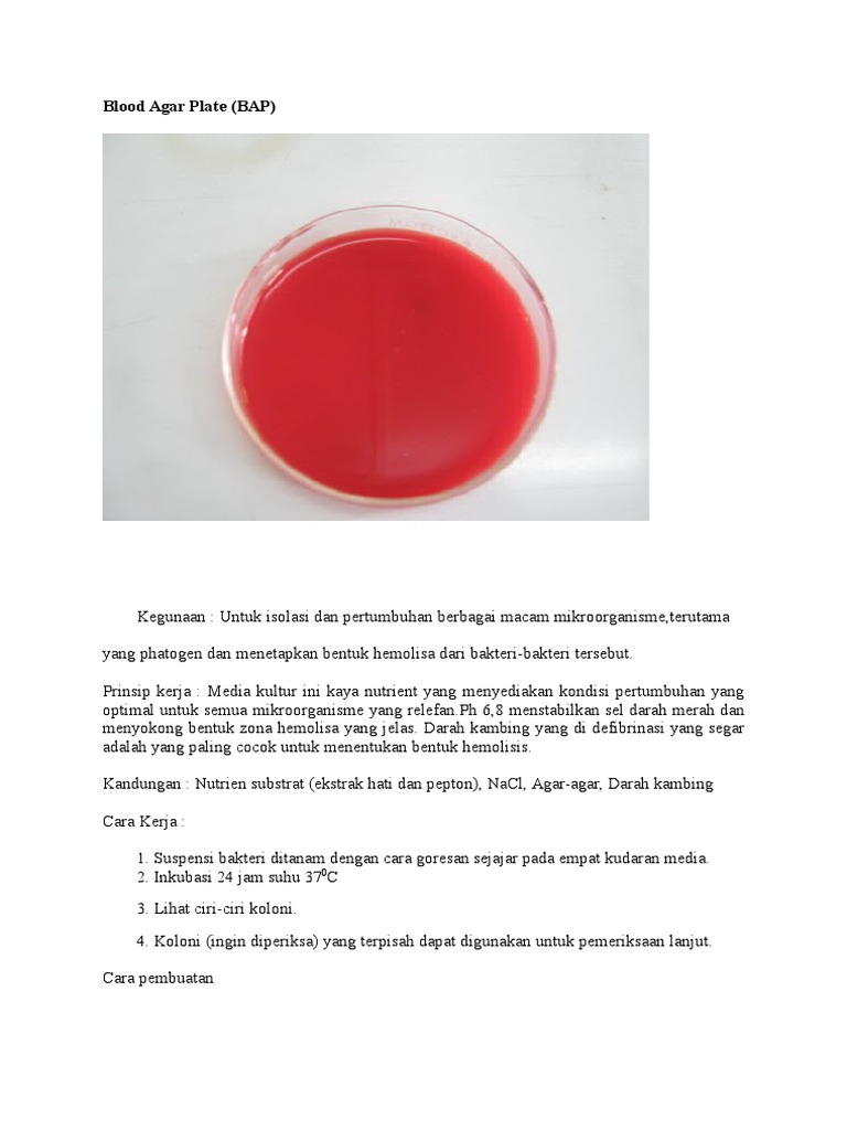 Detail Gambar Koloni Pada Agar Darah Nomer 25