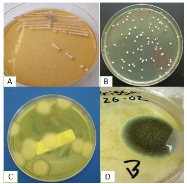 Detail Gambar Koloni Pada Agar Darah Nomer 26