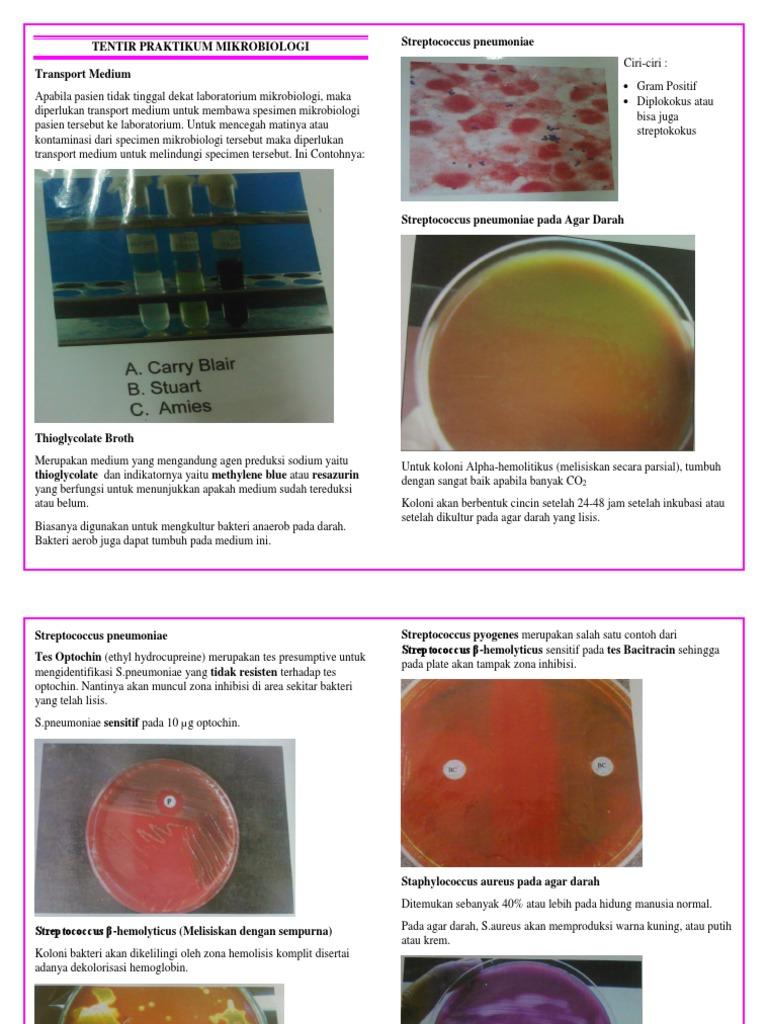 Detail Gambar Koloni Pada Agar Darah Nomer 32