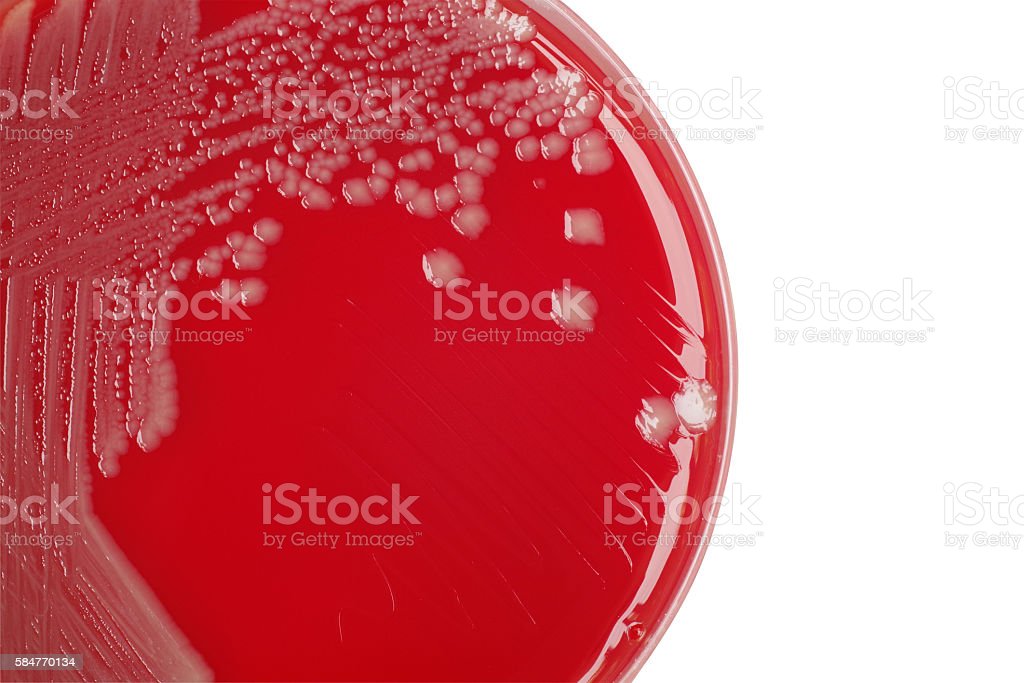 Detail Gambar Koloni Pada Agar Darah Nomer 7