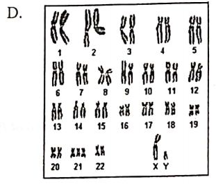 Detail Gambar Kromosom Laki Laki Dan Perempuan Nomer 33