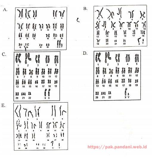 Detail Gambar Kromosom Laki Laki Dan Perempuan Nomer 8