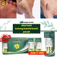 Detail Gambar Kulit Berlubang Nomer 38