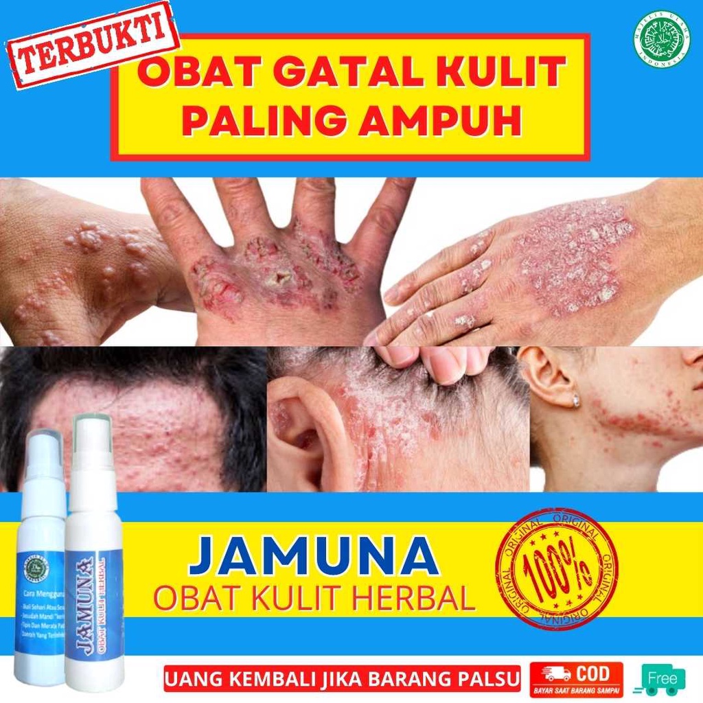 Detail Gambar Kulit Gatal Nomer 37