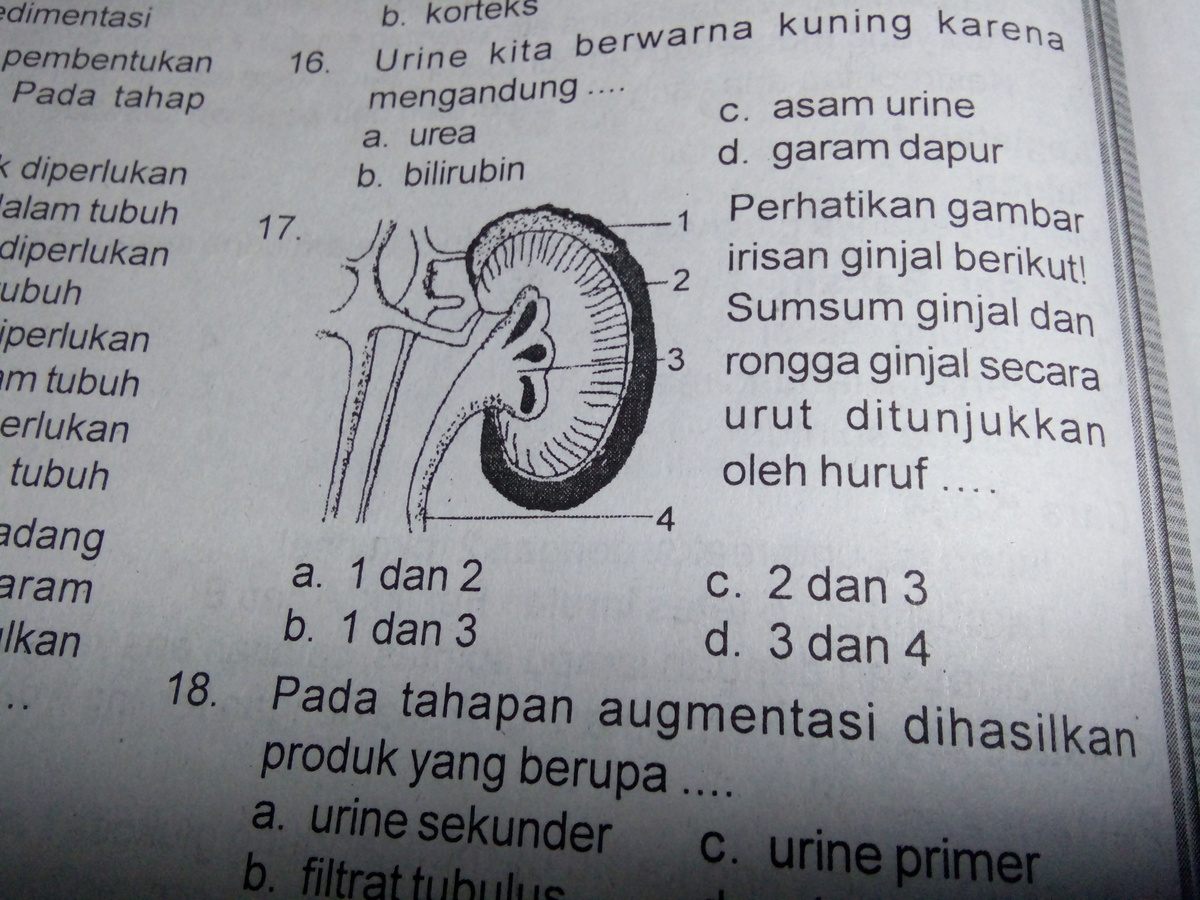 Detail Gambar Kulit Ginjal Nomer 45