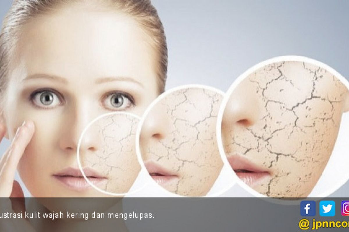 Detail Gambar Kulit Wajah Kering Nomer 29