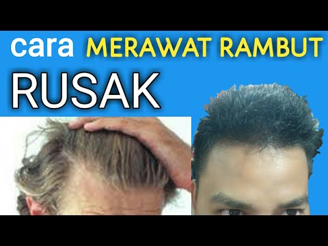 Detail Contoh Rambut Kering Nomer 42