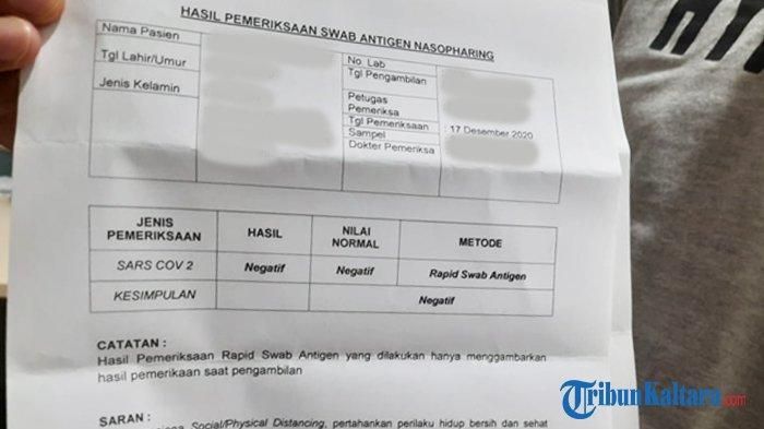 Detail Contoh Rapid Test Antigen Nomer 34