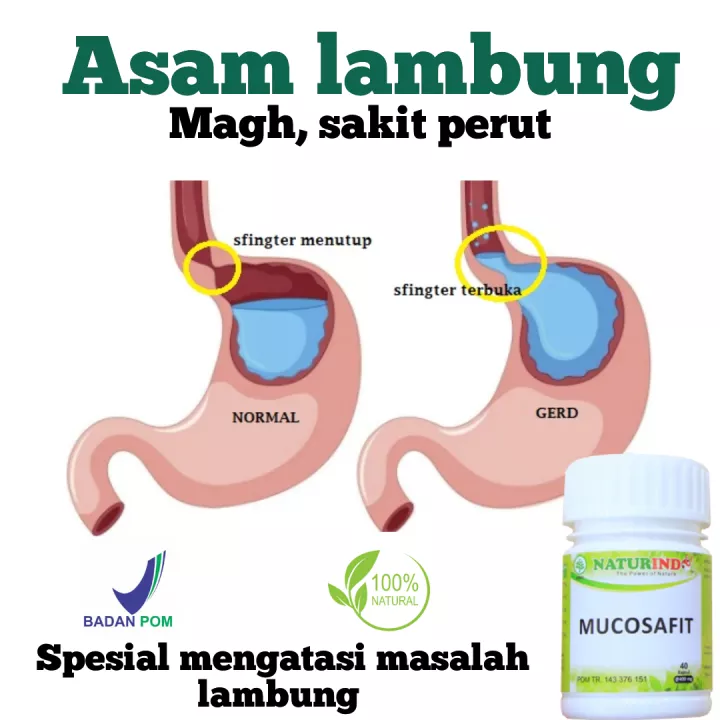 Detail Gambar Lambung Kronis Nomer 35