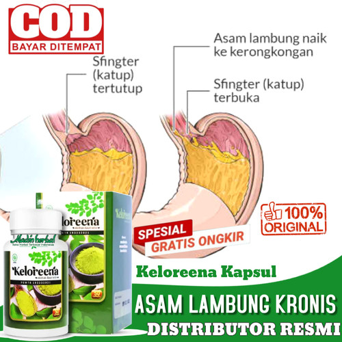 Detail Gambar Lambung Kronis Nomer 47