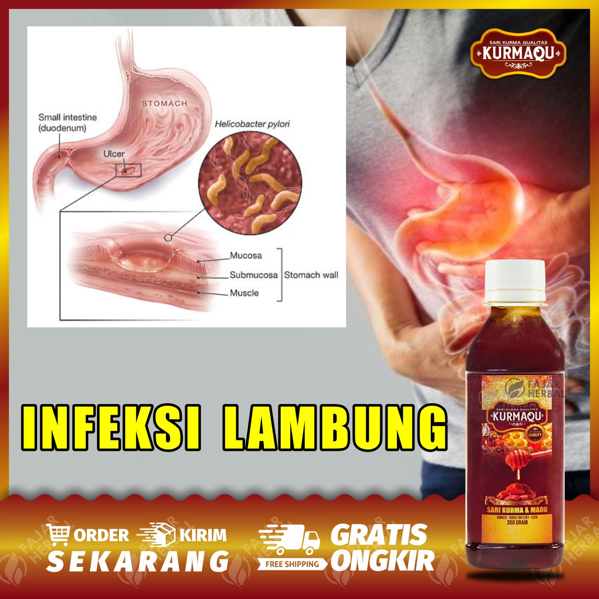 Detail Gambar Lambung Luka Nomer 33