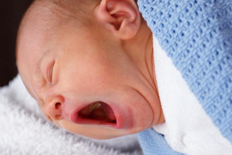 Detail Gambar Langit Langit Mulut Bayi Nomer 11