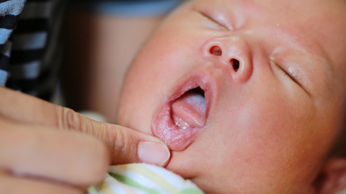 Detail Gambar Langit Langit Mulut Bayi Nomer 16