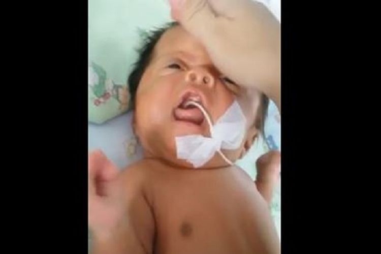 Detail Gambar Langit Langit Mulut Bayi Nomer 2