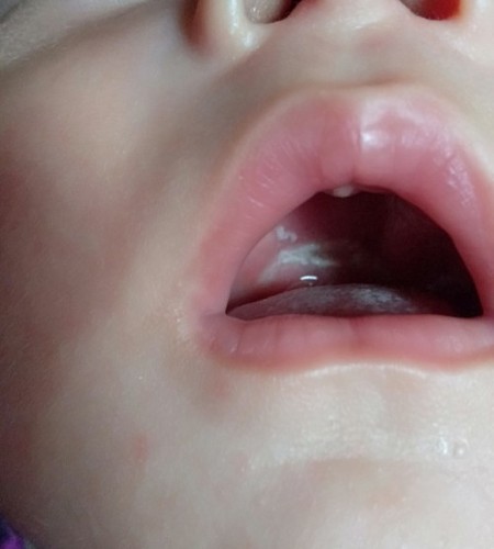 Detail Gambar Langit Langit Mulut Bayi Nomer 19