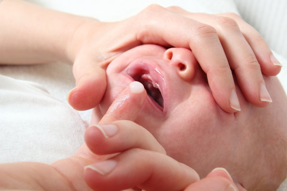 Detail Gambar Langit Langit Mulut Bayi Nomer 28