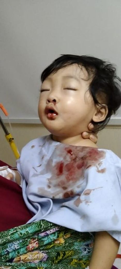 Detail Gambar Langit Langit Mulut Bayi Nomer 30