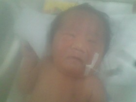 Detail Gambar Langit Langit Mulut Bayi Nomer 34