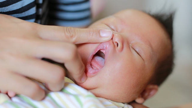 Detail Gambar Langit Langit Mulut Bayi Nomer 35