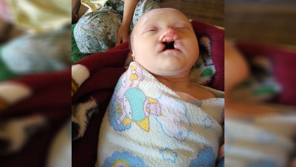 Detail Gambar Langit Langit Mulut Bayi Nomer 39