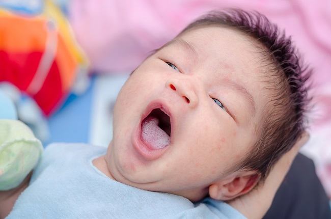 Detail Gambar Langit Langit Mulut Bayi Nomer 40