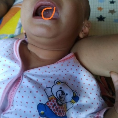 Detail Gambar Langit Langit Mulut Bayi Nomer 4