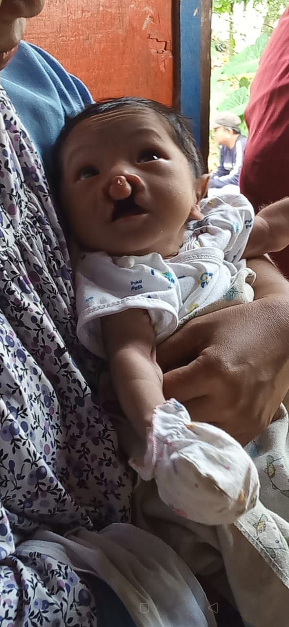 Detail Gambar Langit Langit Mulut Bayi Nomer 48