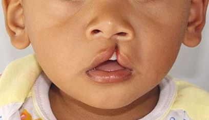 Detail Gambar Langit Langit Mulut Bayi Nomer 52