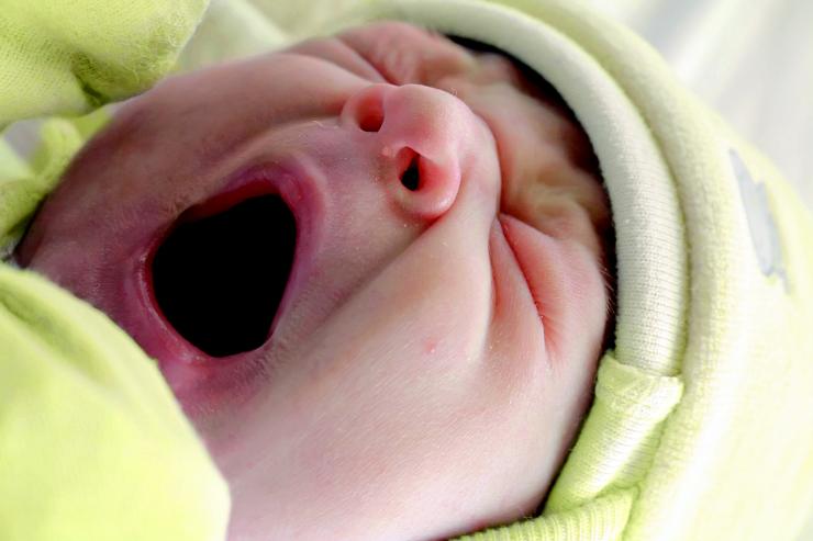 Detail Gambar Langit Langit Mulut Bayi Nomer 54