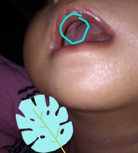 Detail Gambar Langit Langit Mulut Bayi Nomer 5
