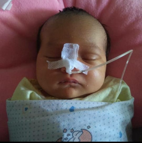 Detail Gambar Langit Langit Mulut Bayi Nomer 7