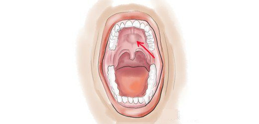 Detail Gambar Langit Langit Mulut Yang Sehat Nomer 50