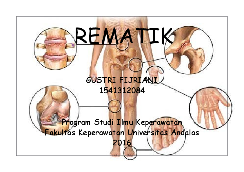 Detail Gambar Leaflet Reumatik Nomer 53