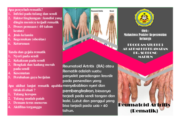 Detail Gambar Leaflet Reumatik Nomer 8