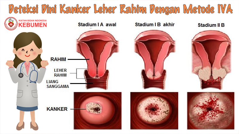 Detail Gambar Leher Rahim Nomer 15