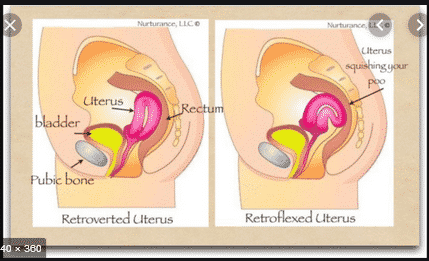 Detail Gambar Letak Janin Kep Nomer 22