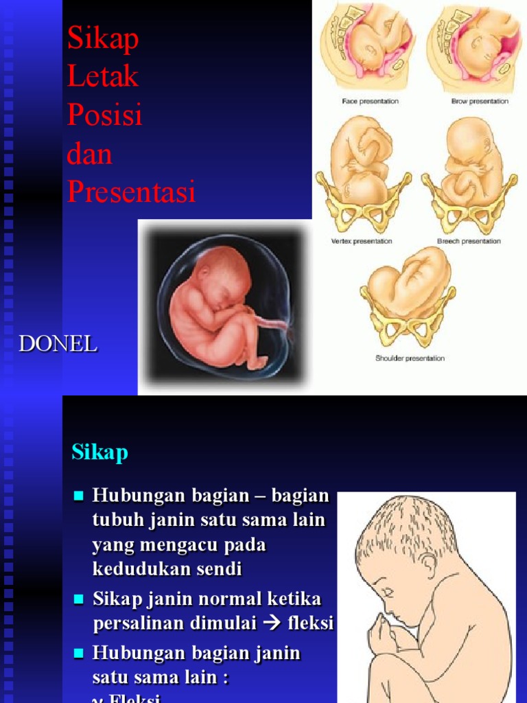 Detail Gambar Letak Janin Kep Nomer 27