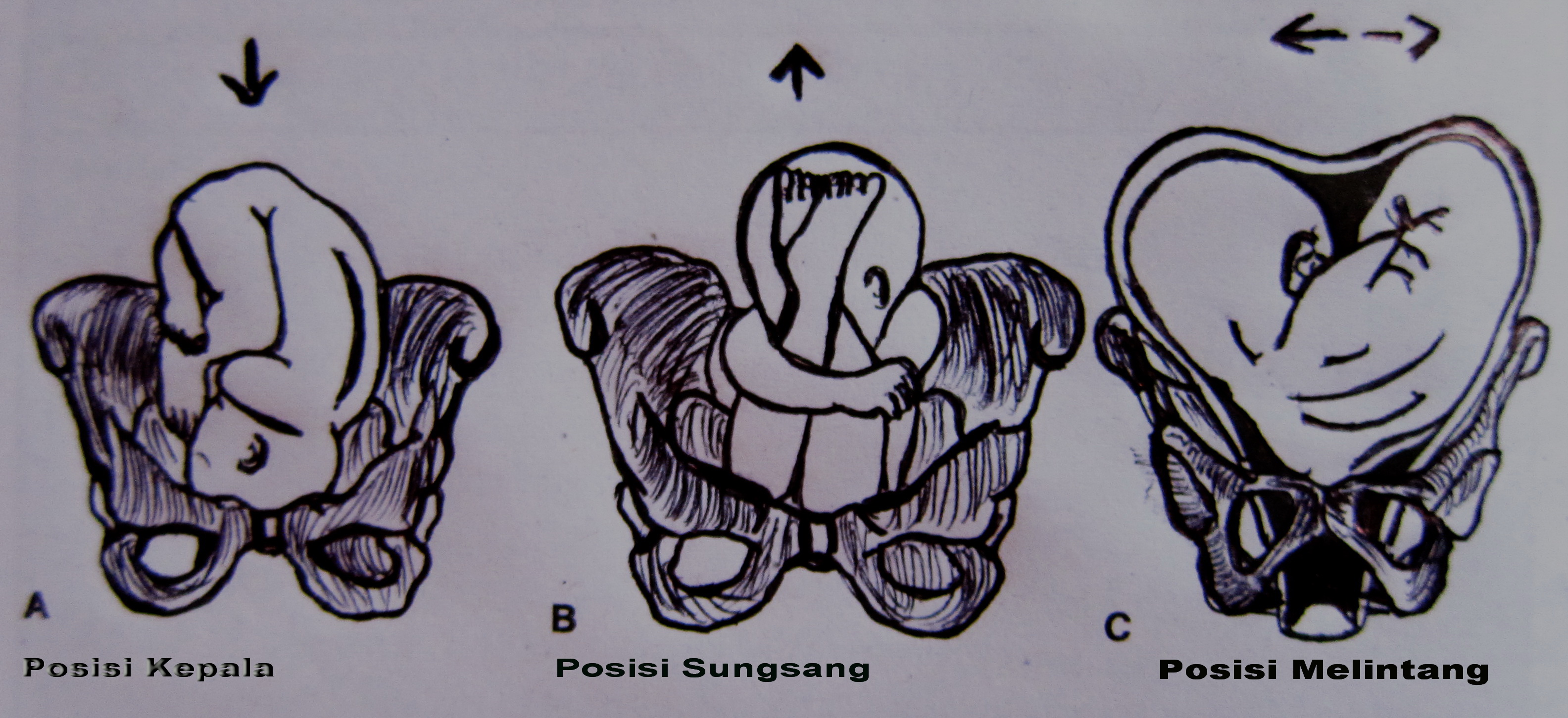 Detail Gambar Letak Janin Kep Nomer 6