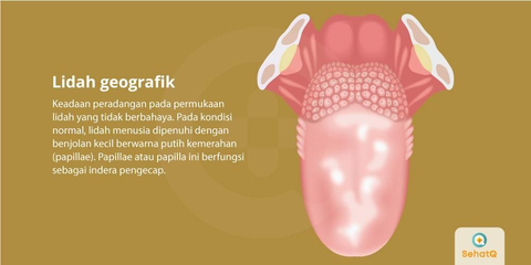 Detail Gambar Lidah Yang Sehat Nomer 23