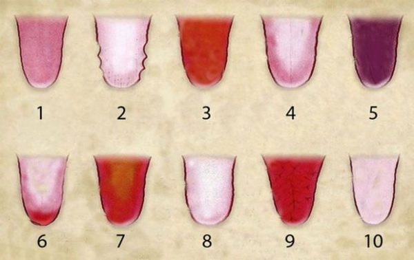 Detail Gambar Lidah Yang Sehat Nomer 30