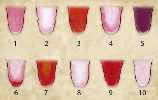 Detail Gambar Lidah Yang Sehat Nomer 30