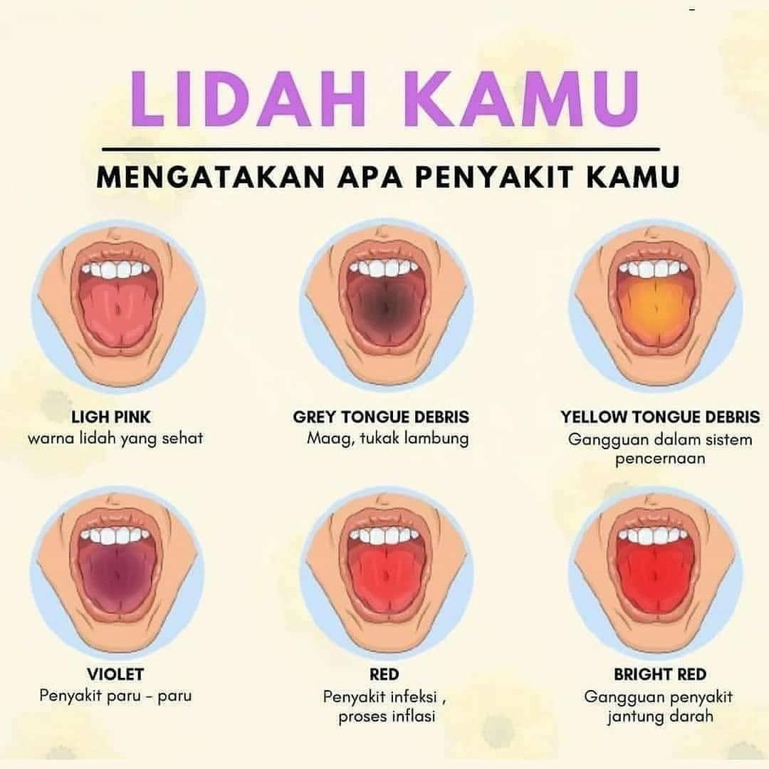 Detail Gambar Lidah Yang Sehat Nomer 31