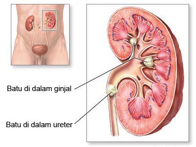 Detail Contoh Sistem Ekskresi Nomer 35