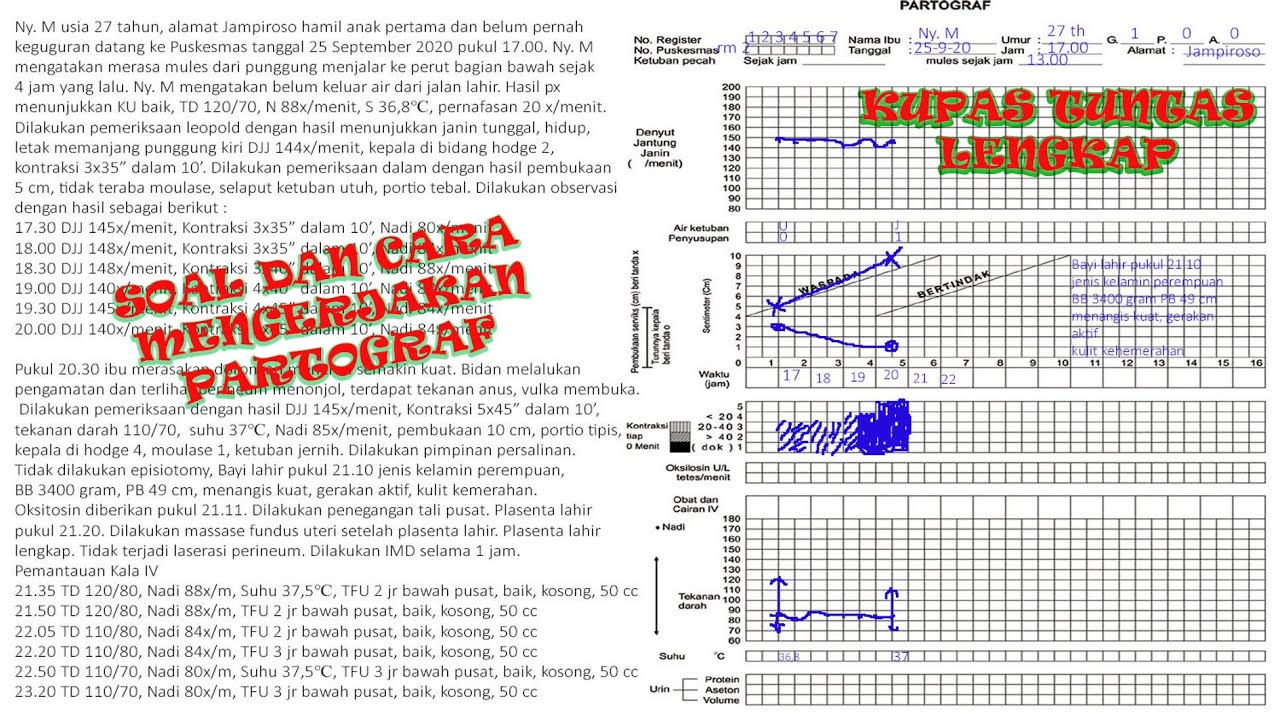 Detail Contoh Soal Partograf Dan Gambarnya Nomer 2