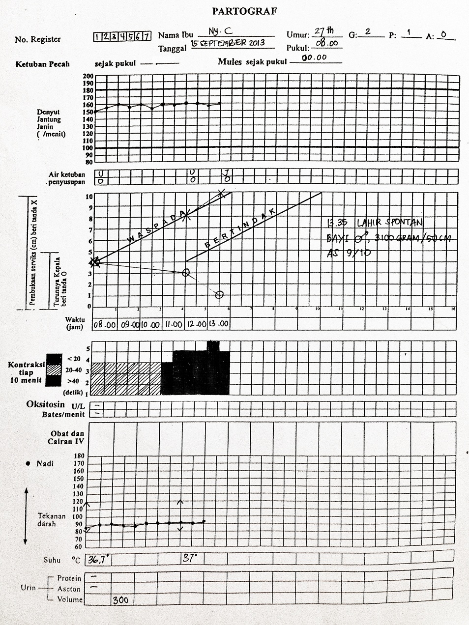 Detail Contoh Soal Partograf Dan Gambarnya Nomer 10