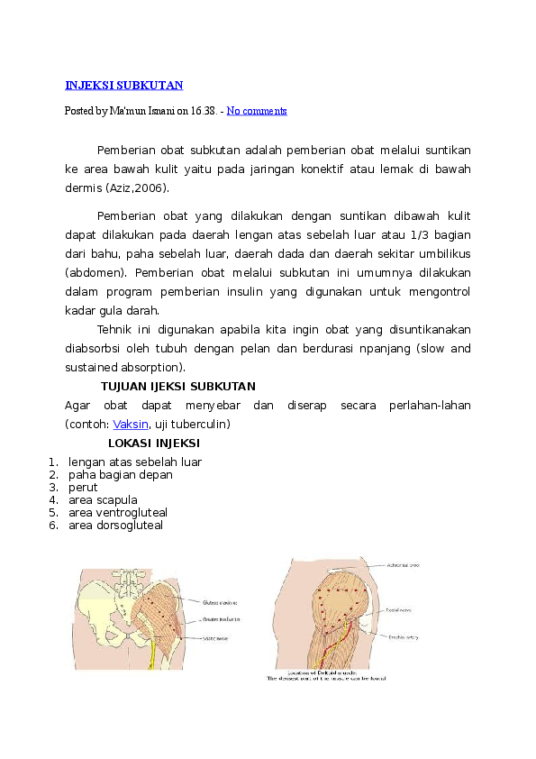 Detail Gambar Lokasi Injeksi Intramuskular Nomer 49