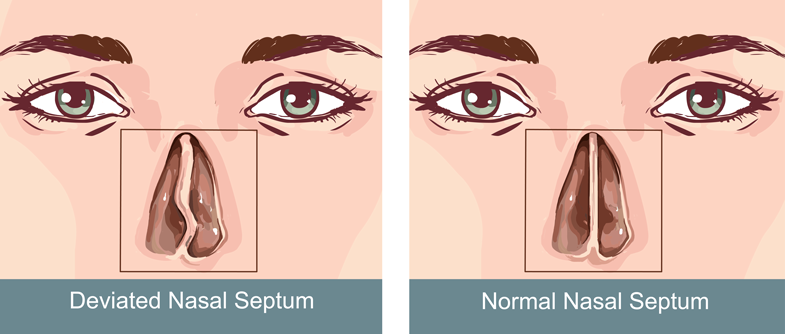 Detail Gambar Lubang Hidung Normal Nomer 17