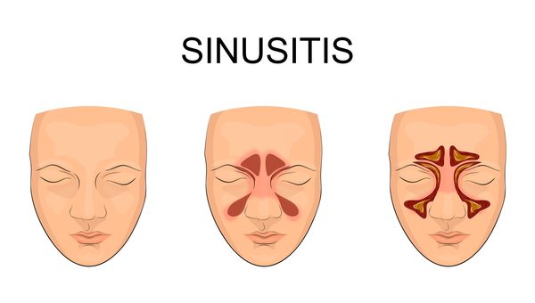 Detail Gambar Lubang Hidung Normal Nomer 30