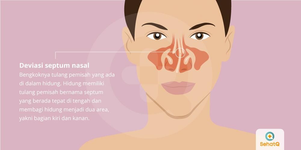 Detail Gambar Lubang Hidung Normal Nomer 48