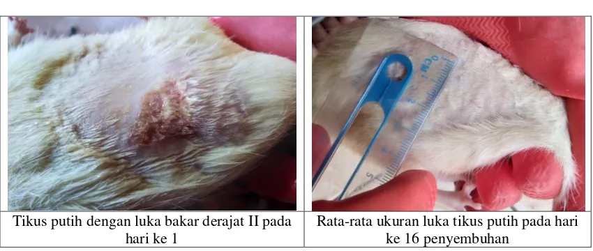 Detail Gambar Luka Bakar Derajat 2 Nomer 54